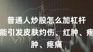 普通人炒股怎么加杠杆可能引发皮肤灼伤、红肿、疼痛